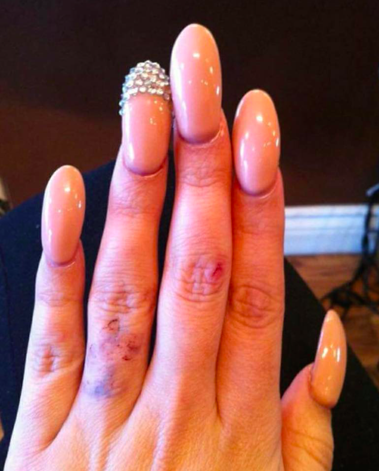 Ugly Nails on the internet
